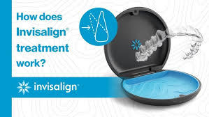 Invisalign Como Funciona